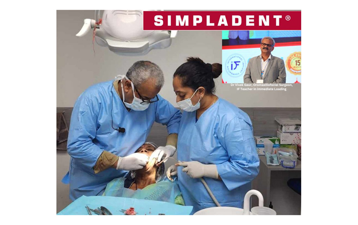 Simpladent Revolutionizes Dental Implants in India with Groundbreaking Corticobasal Technology, Offering Smiles in Just 48 Hours